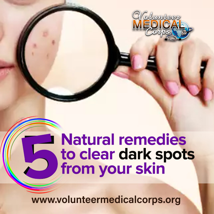 5 Natural Remedies to Clear Dark Spots From Your Skin.
